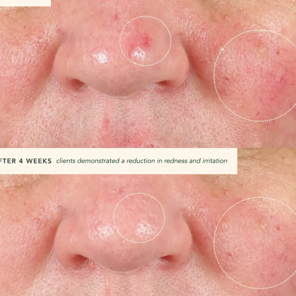 Restoring Moonseed Treatment - Ayurvedischer Balm für Feuchtigkeit und Hautberuhigung