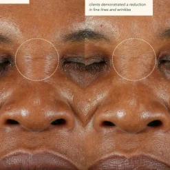 Restoring Moonseed Treatment - Ayurvedischer Balm für Feuchtigkeit und Hautberuhigung